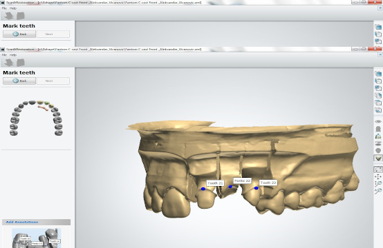 dentisterie cad/cam