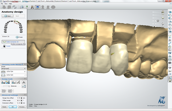 dentisterie cad/cam