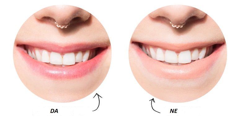 blistav osmeh za 1minut (beljenje zuba) - trikovi