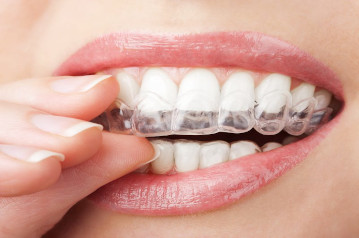 skripanje zubima – bruksizam
